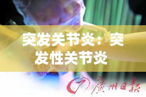 突发关节炎：突发性关节炎 