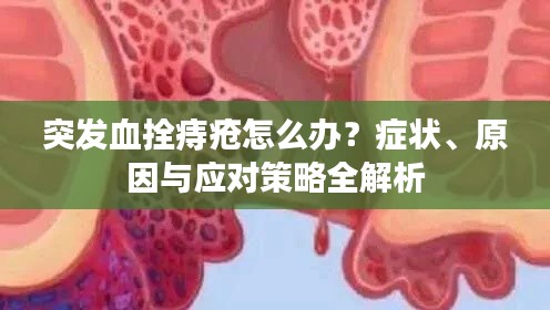突发血拴痔疮怎么办？症状、原因与应对策略全解析